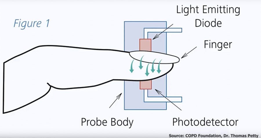 How a Pulse Oximeter Works Overview of Pulse Oximeters